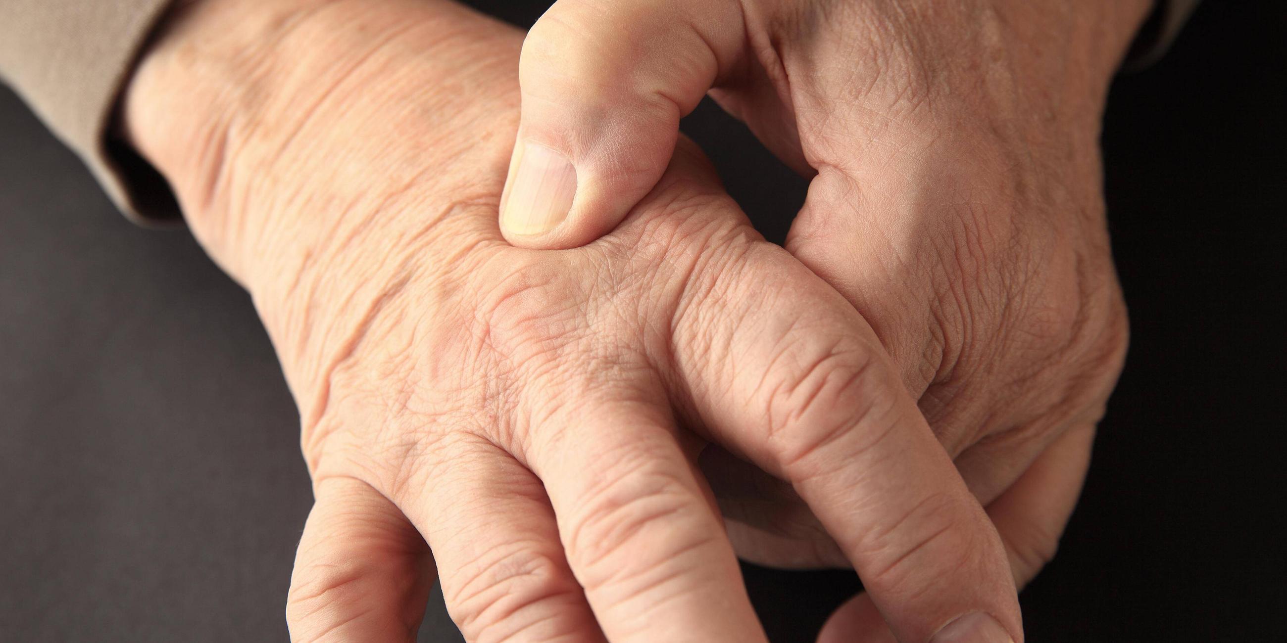 Ein älterer Mann mit Gelenkschmerzen in der Hand
