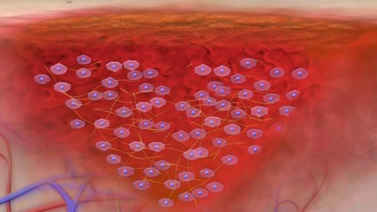 Grfik Wundheilung - Fibroplasten