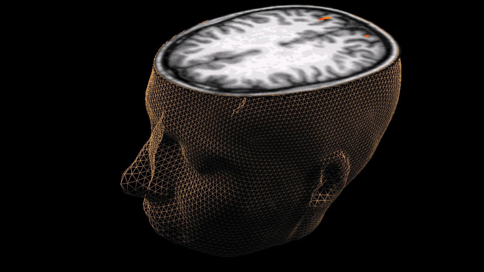 Grafik eines angeschnittenen Gehirns im Kopf