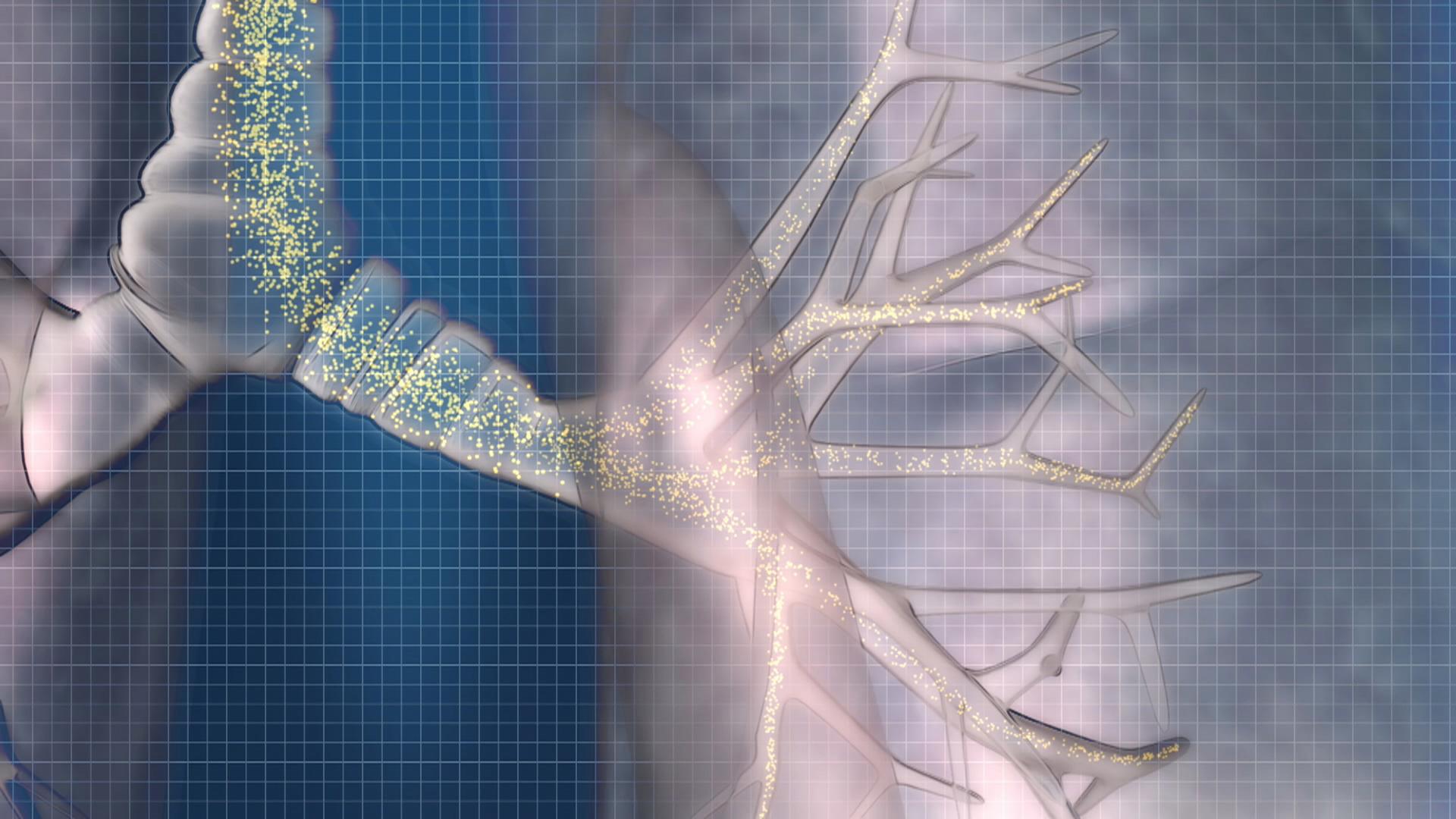 Grafik: PM Partikel in Lungenverästelungen