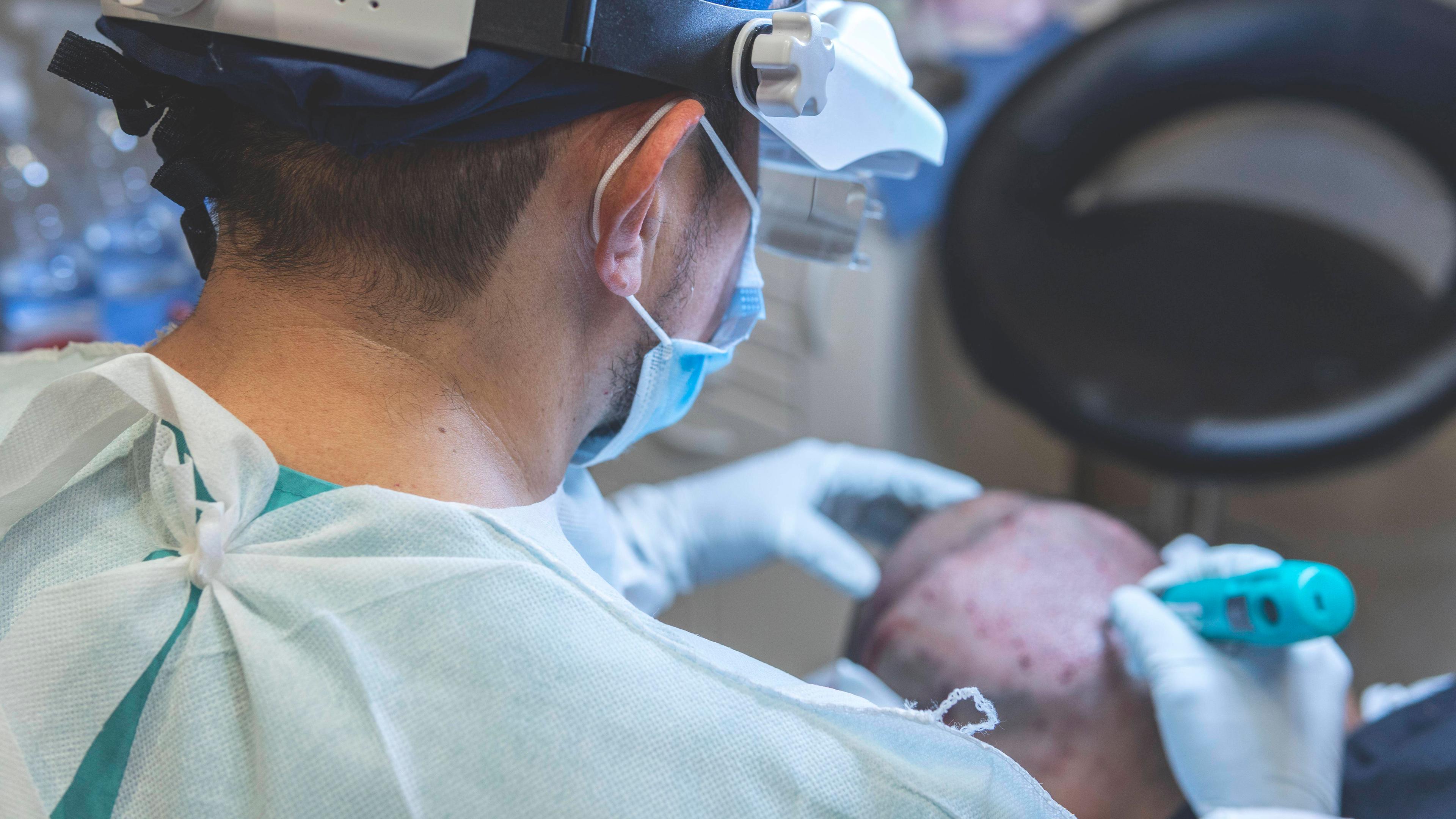 Ein Chirurg im Operationssaal führt eine Haartransplantation durch.