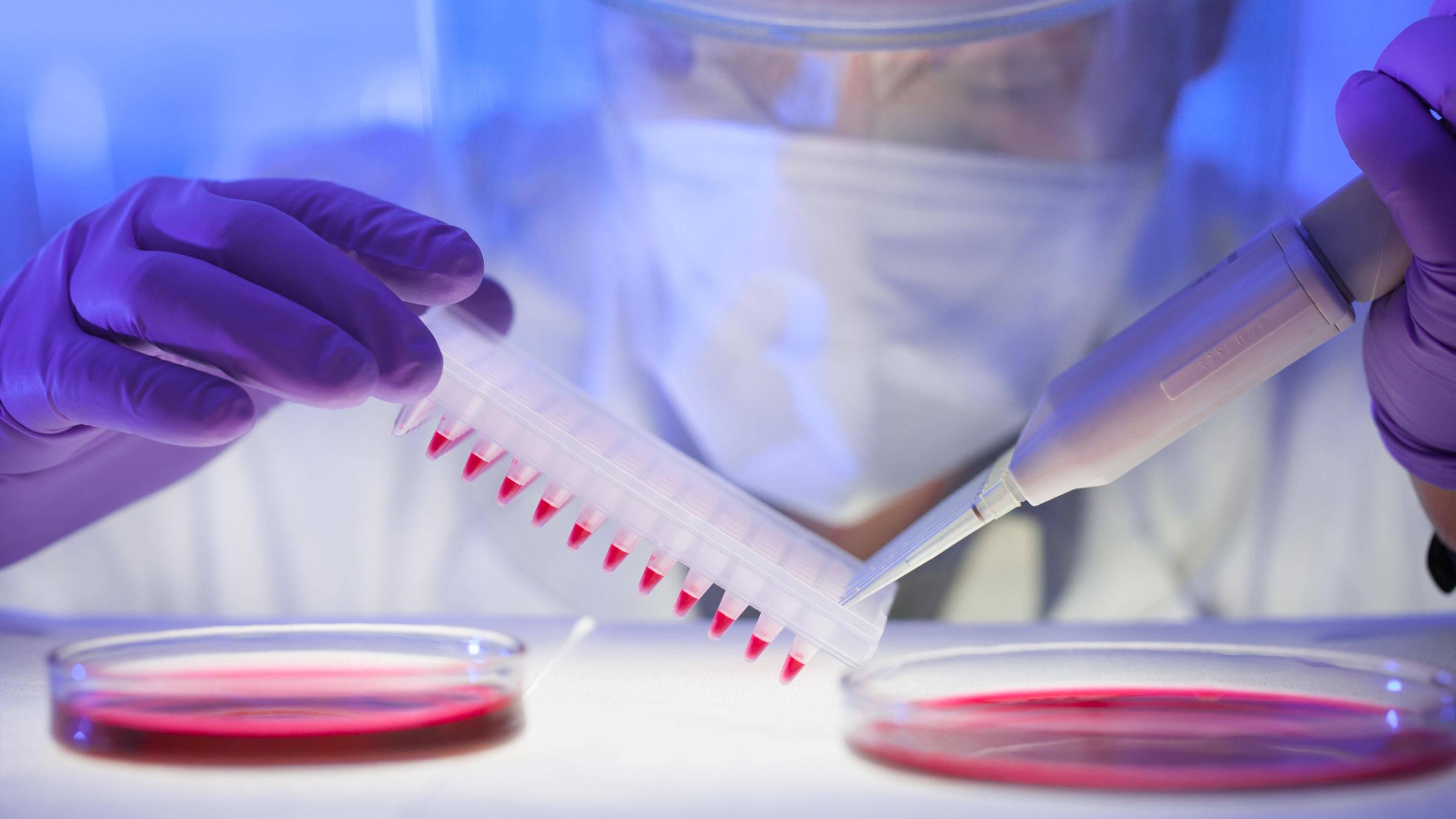 Humanserummedien mit HIV-infizierten Zellen werden von der Petrischale auf eine Mikrotiterplatte pipettiert. 