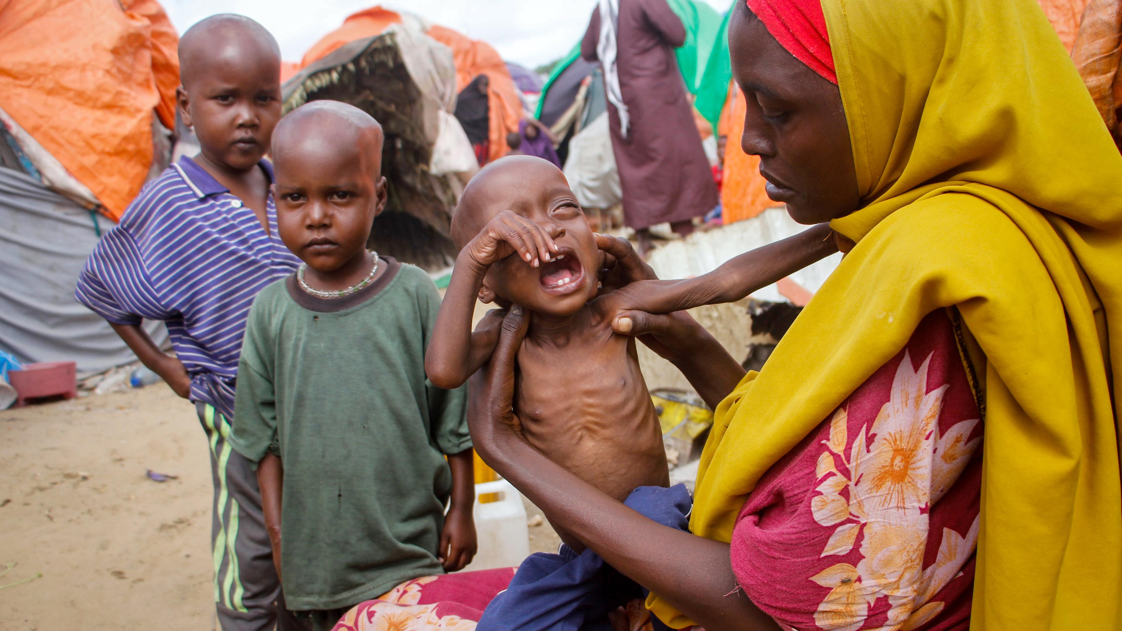 Eine Mutter in Somalia hält ihr schreiendes, unternernährtes Kind in den Armen. Neben ihr stehen zwei weitere, dünne Kinder, im Hintergrund sind Zelte zu sehen. (Archivbild)