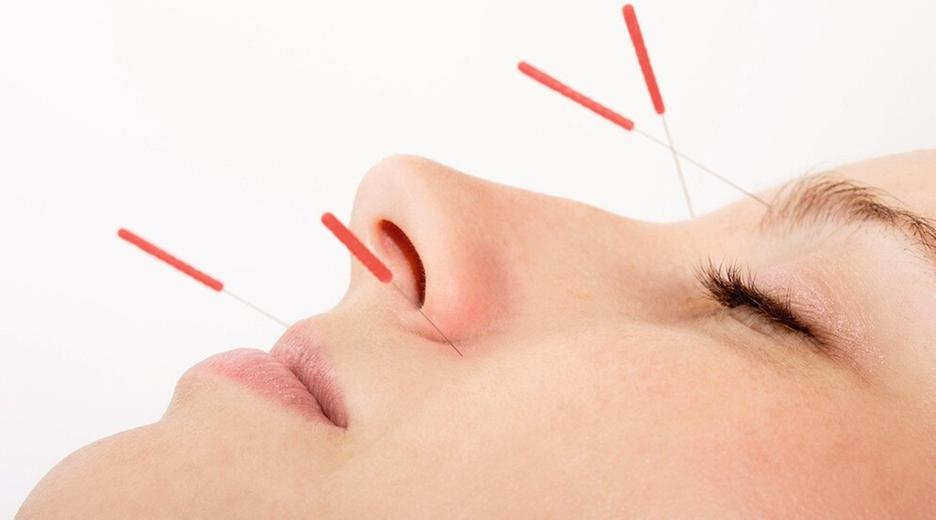 Akupunktur gegen Schmerzen, Kräutersalben, Spargel