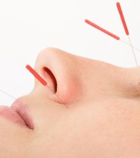 Akupunktur gegen Schmerzen, Kräutersalben, Spargel