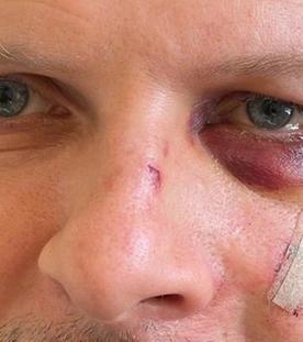 Angriffe auf Politiker: Helfen härtere Strafen?