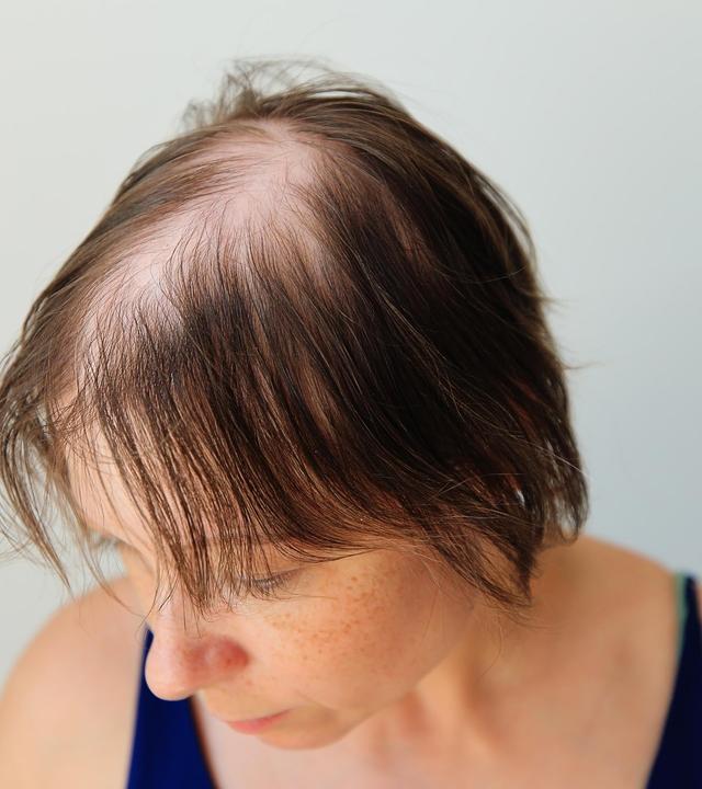 Haarausfall, Achtsam essen, gute Therapeuten