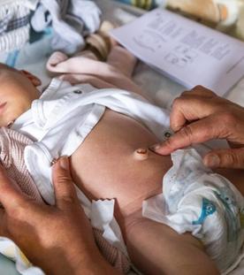 Hebammen, Meningokokken-B-Impfung, Schwangere mit Übergewicht