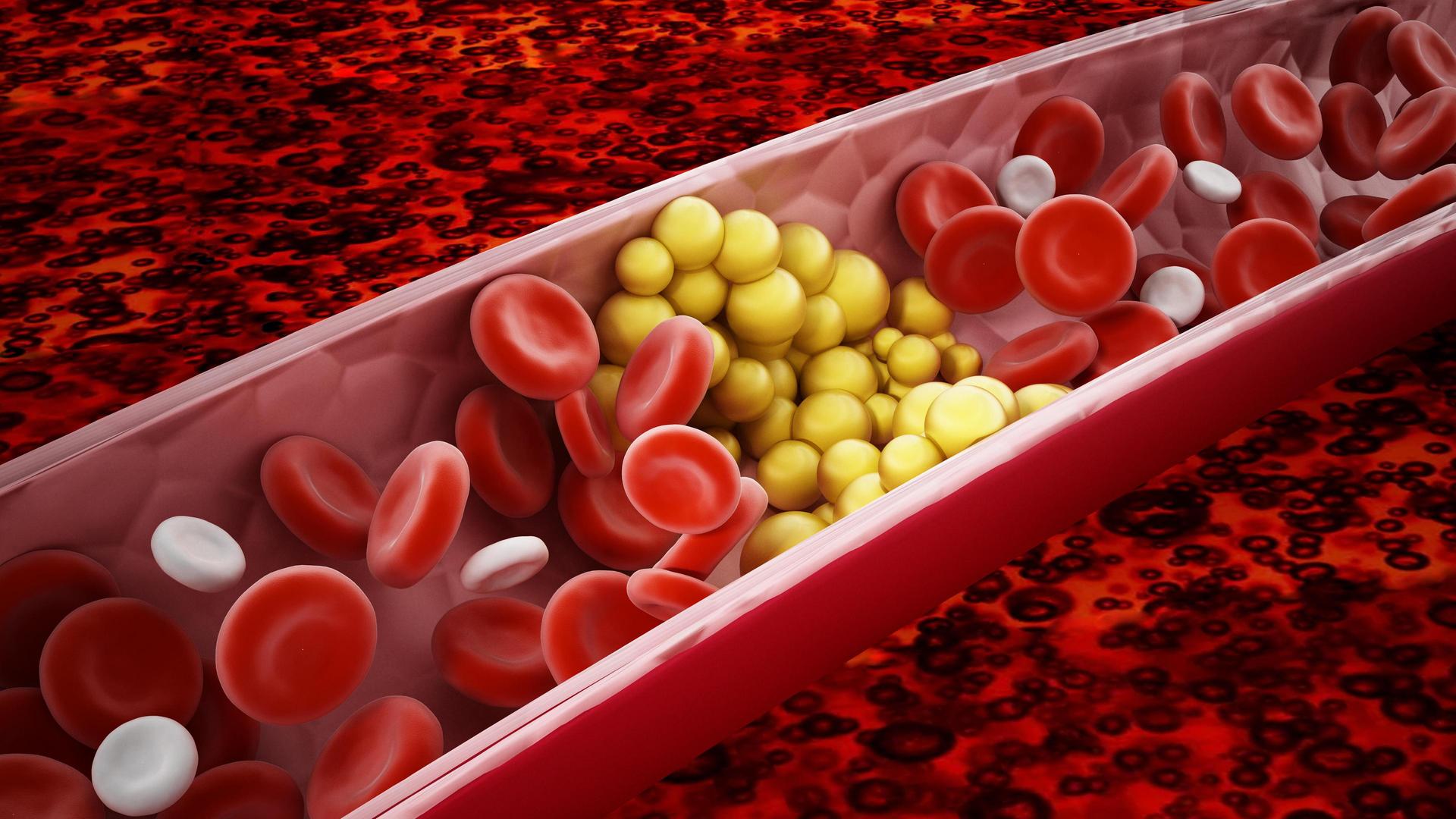 LDL-Cholesterin, Stoffe bei Hitze, Bodyshaming