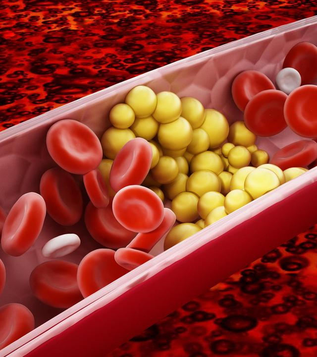 LDL-Cholesterin, Stoffe bei Hitze, Bodyshaming