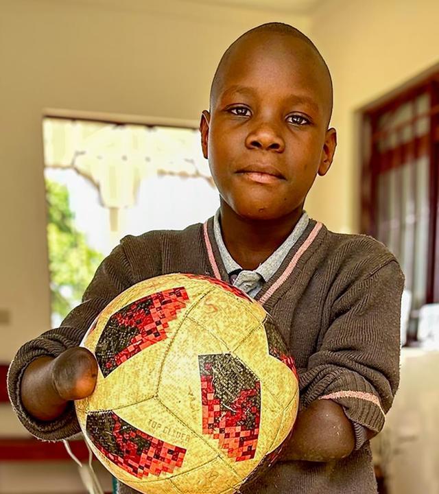 Perspektiven durch Prothesen