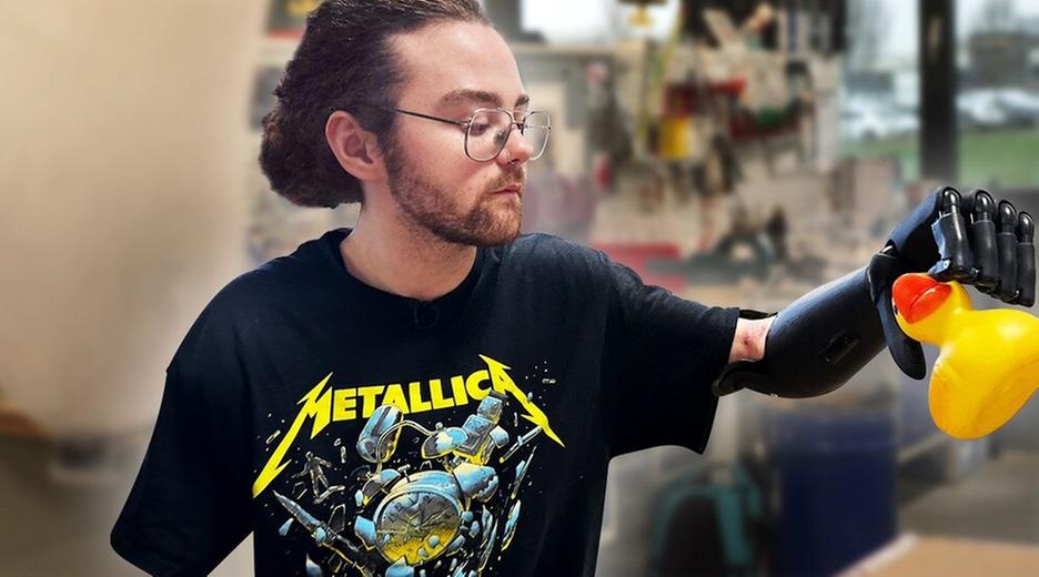 Prothese nach Amputation: Kann ich endlich normal leben?