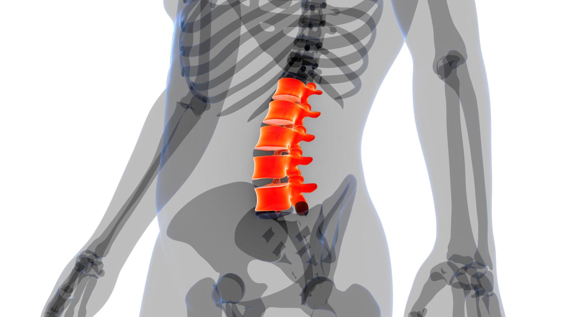 Spinale Stenose, Beckenbodentraining, Medizin von morgen