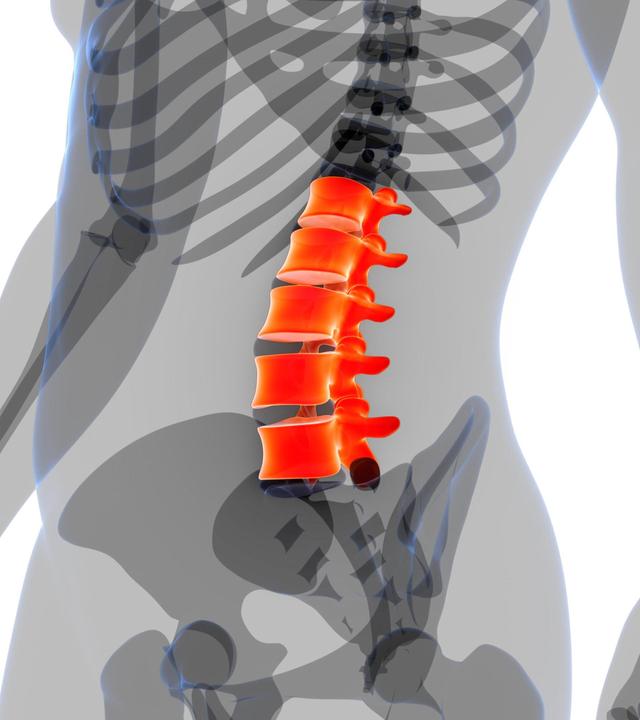 Spinale Stenose, Beckenbodentraining, Medizin von morgen