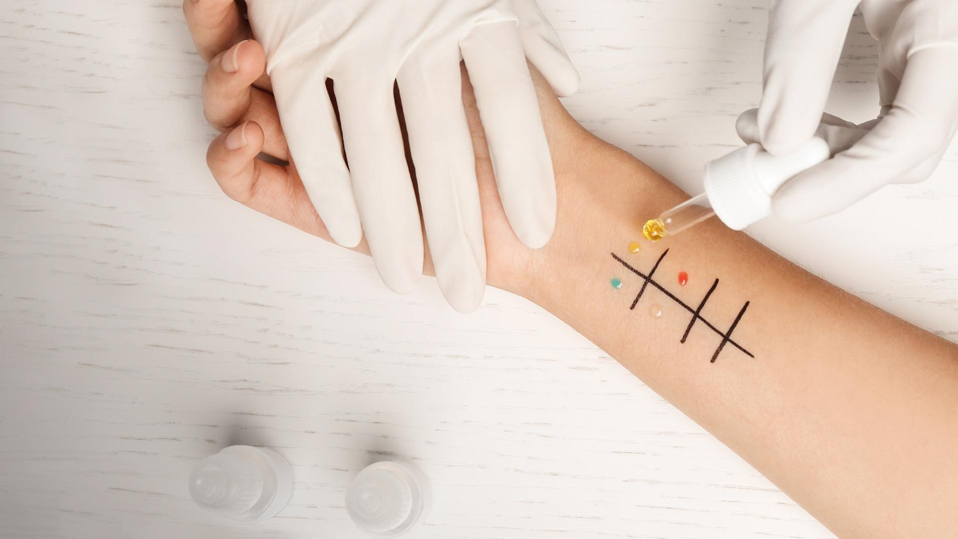 Stärker im Team: das Allergiezentrum Hessen