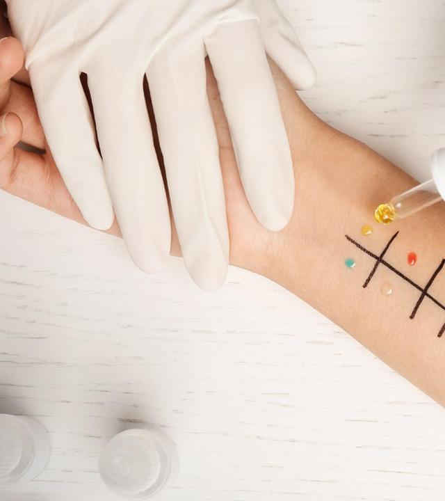 Stärker im Team: das Allergiezentrum Hessen