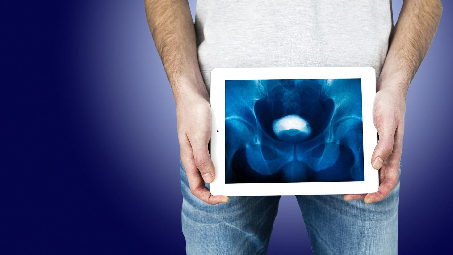 Unter der Gürtellinie – mit dem Urologen im OP