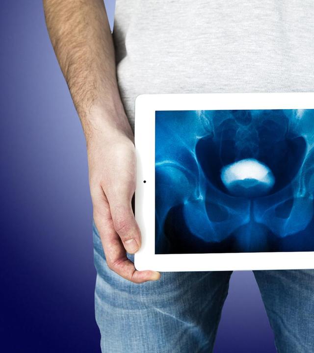 Unter der Gürtellinie – mit dem Urologen im OP