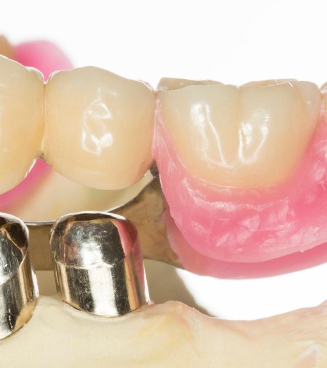 Welcher Zahnersatz?, Medikamente und Hitze, Löwenzahn