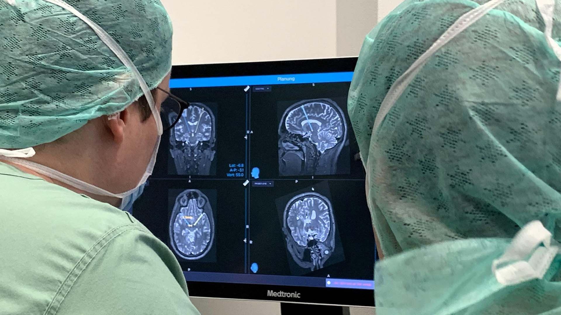 Gehirn unter Strom - Hilfe bei Depression, Epilepsie und Parkinson?