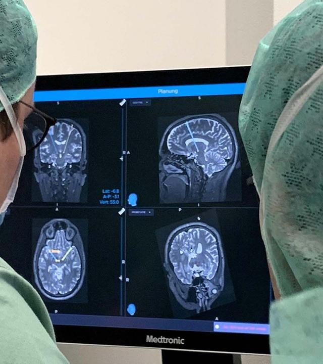 Gehirn unter Strom - Hilfe bei Depression, Epilepsie und Parkinson?