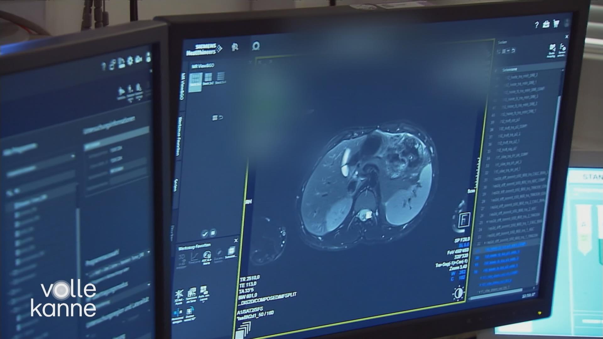 Röntgenaufnahme auf Bildschirm