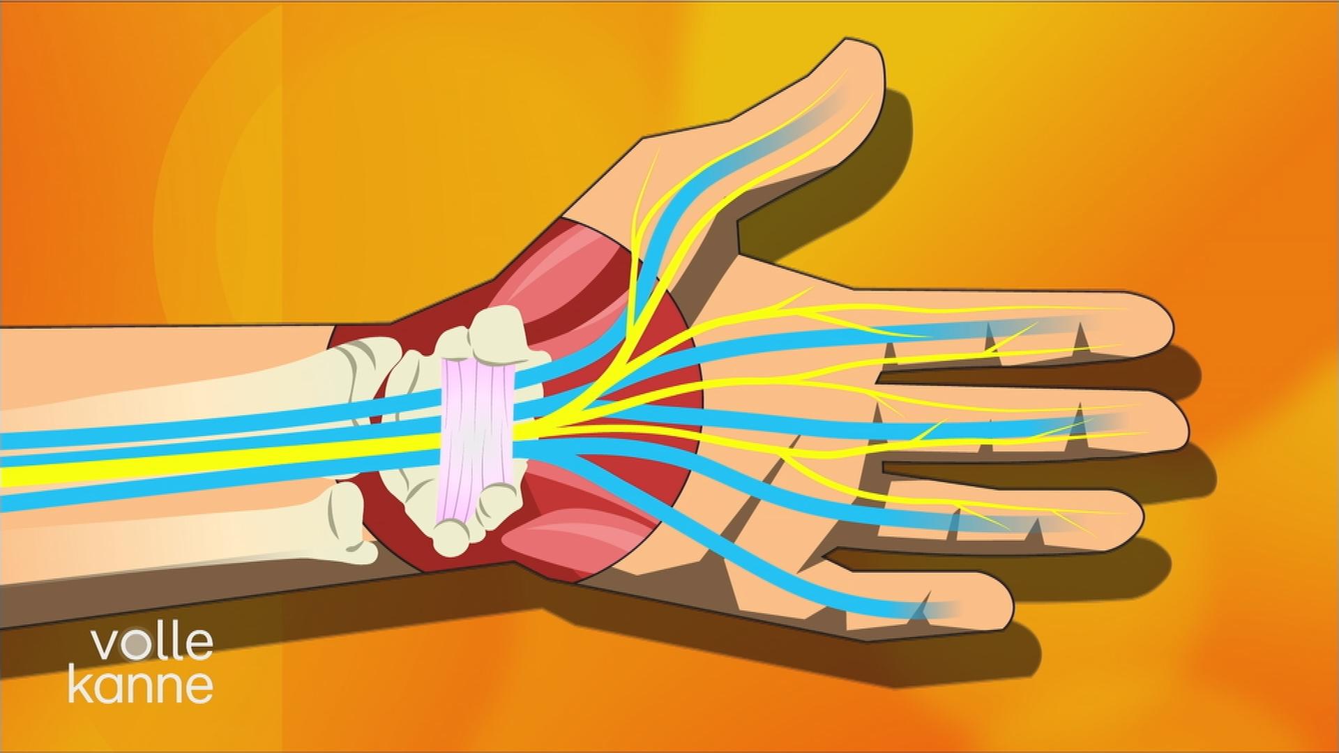 Künstliches Modell einer Hand, wo man Knochen und Sehnen sieht