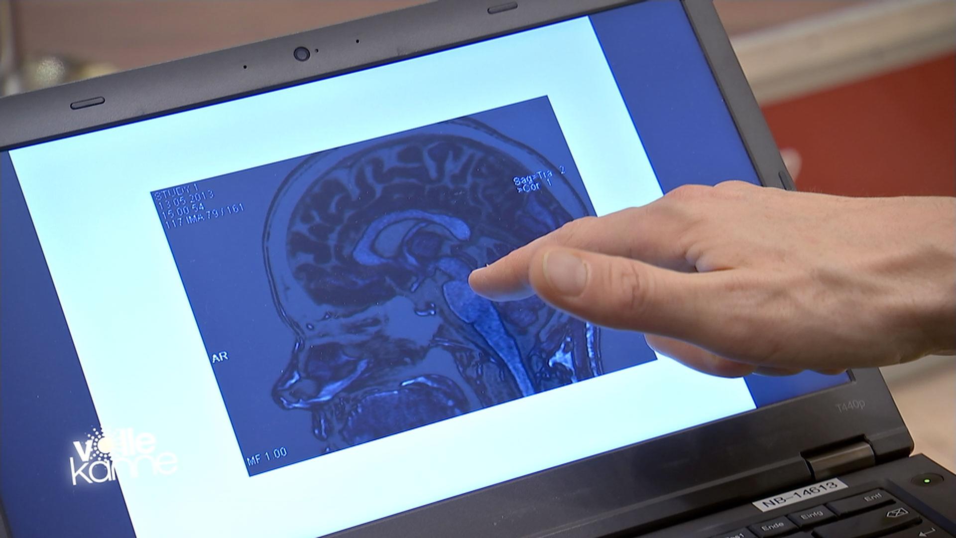 Kaufrausch entsteht im Gehirn.