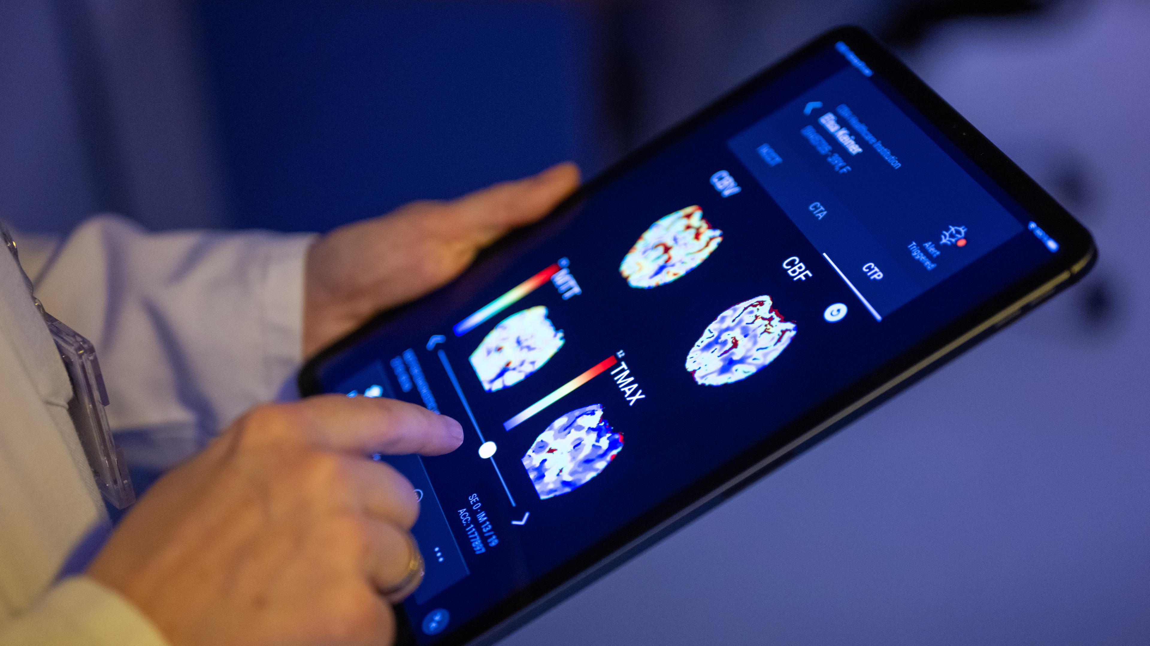 Eine Radiologin bedient eine KI-basierte App auf einem Tablet, um Gehirnbilder eines Patienten auszuwerten.