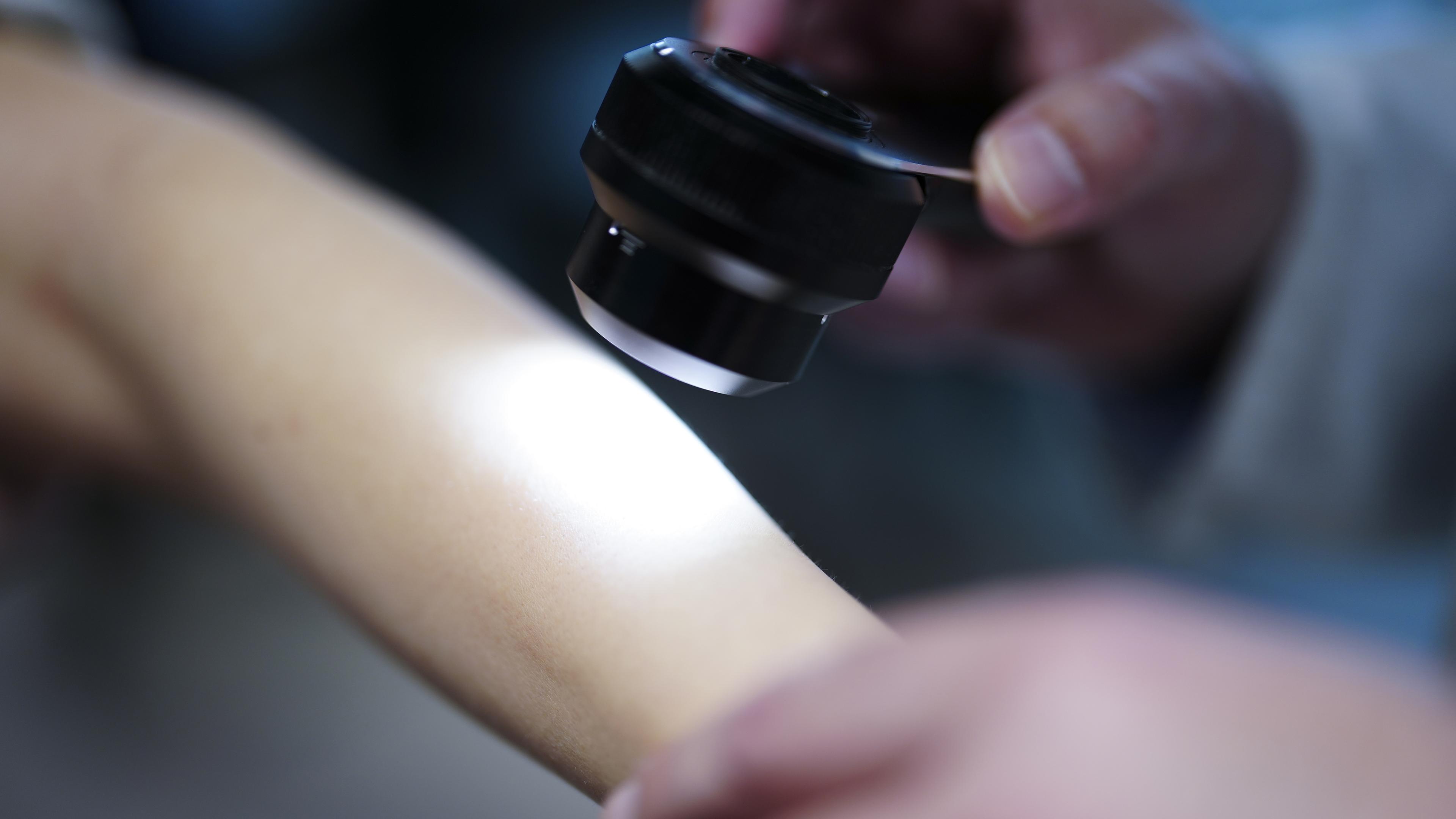  Ein Hautarzt untersucht bei einer Krebsvorsorgeuntersuchung eine Patientin mit einem Auflichtmikroskop.