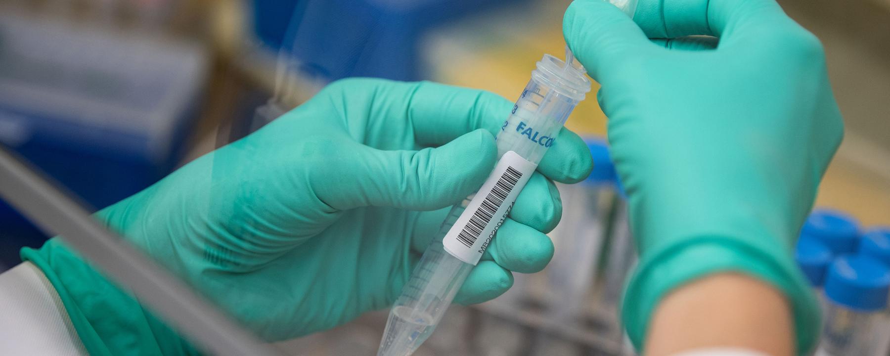 Im Labor werden positive Proben auf die Virus-Varianten untersucht. 