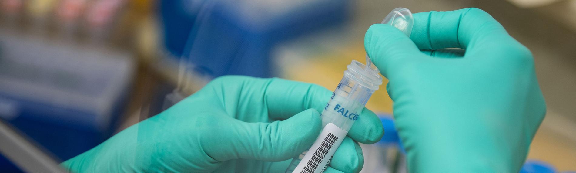 Im Labor werden positive Proben auf die Virus-Varianten untersucht. 