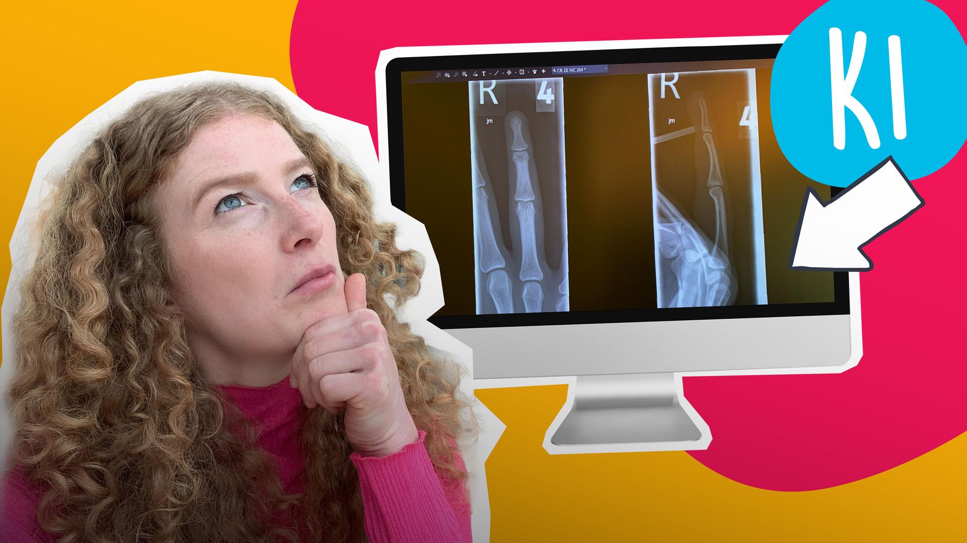 Bild für Krankenhaus-KI: So erkennt sie Knochenbrüche