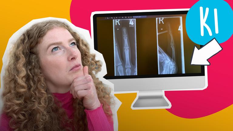 Krankenhaus-KI: So erkennt sie Knochenbrüche