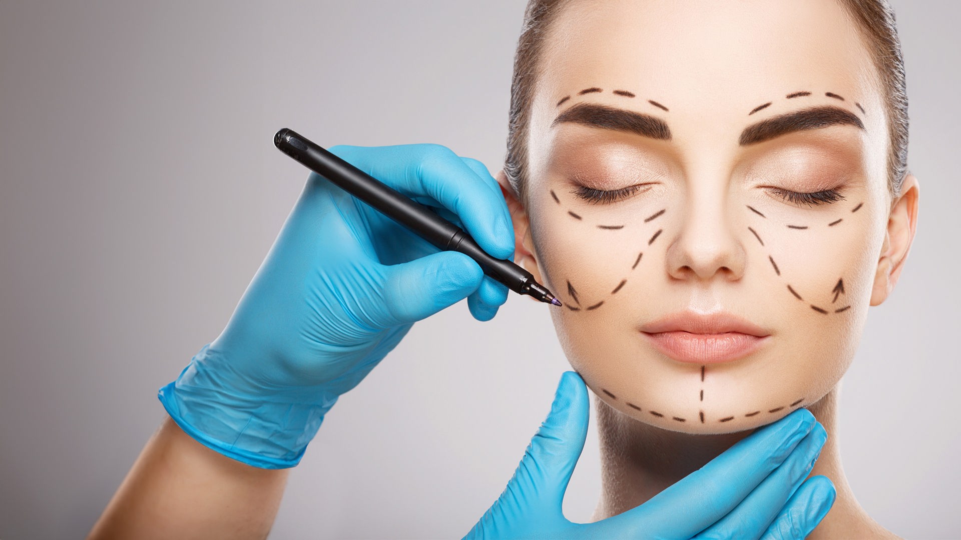 Das Gesicht einer Frau mit dunklen Augenbrauen vor hellem Studiohintergrund: Die Hände eines Arztes tragen blaue Handschuhe und zeichnen mit einem Stift Linien auf das Gesicht.
