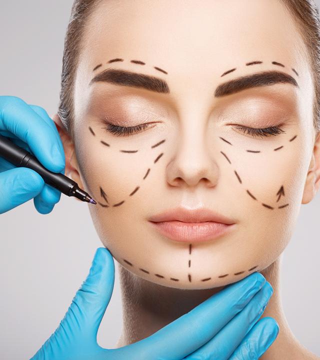 Das Gesicht einer Frau mit dunklen Augenbrauen vor hellem Studiohintergrund: Die Hände eines Arztes tragen blaue Handschuhe und zeichnen mit einem Stift Linien auf das Gesicht.