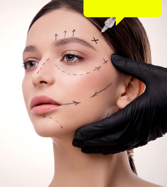 Eine junge Frau bekommt eine Botox-Spritze, in ihrem Gesicht sind verschiedene Markierungen eingemalt