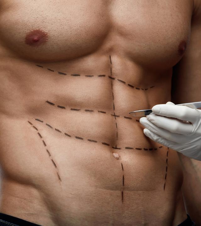 Ein männlicher, durchtrainierter Oberkörper ist mit Linien gekennzeichnet, an der Seite ist davor eine Hand mit einem Skalpell.