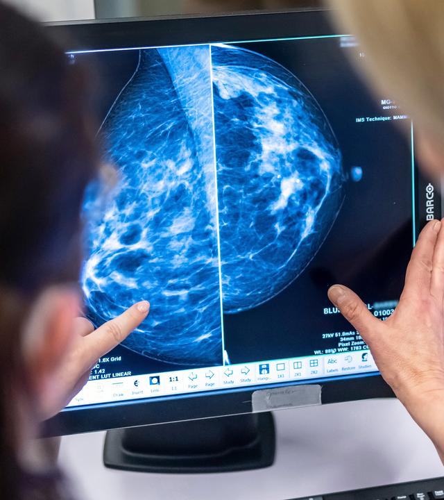 Mammographie für Brustkrebsuntersuchung