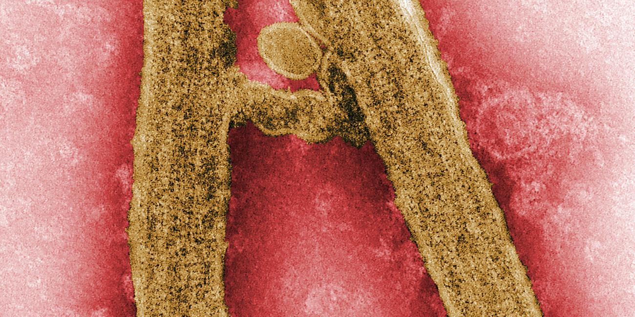 Kolorierte Aufnahme des Marburg-Viruspartikels unter einem Elektronenmikroskop.