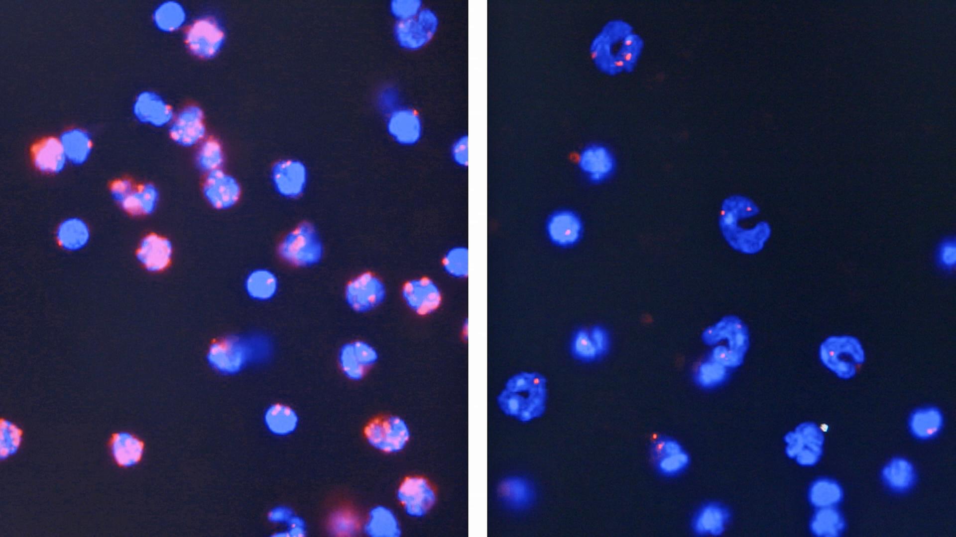 Die Gendermedizin Zdfmediathek