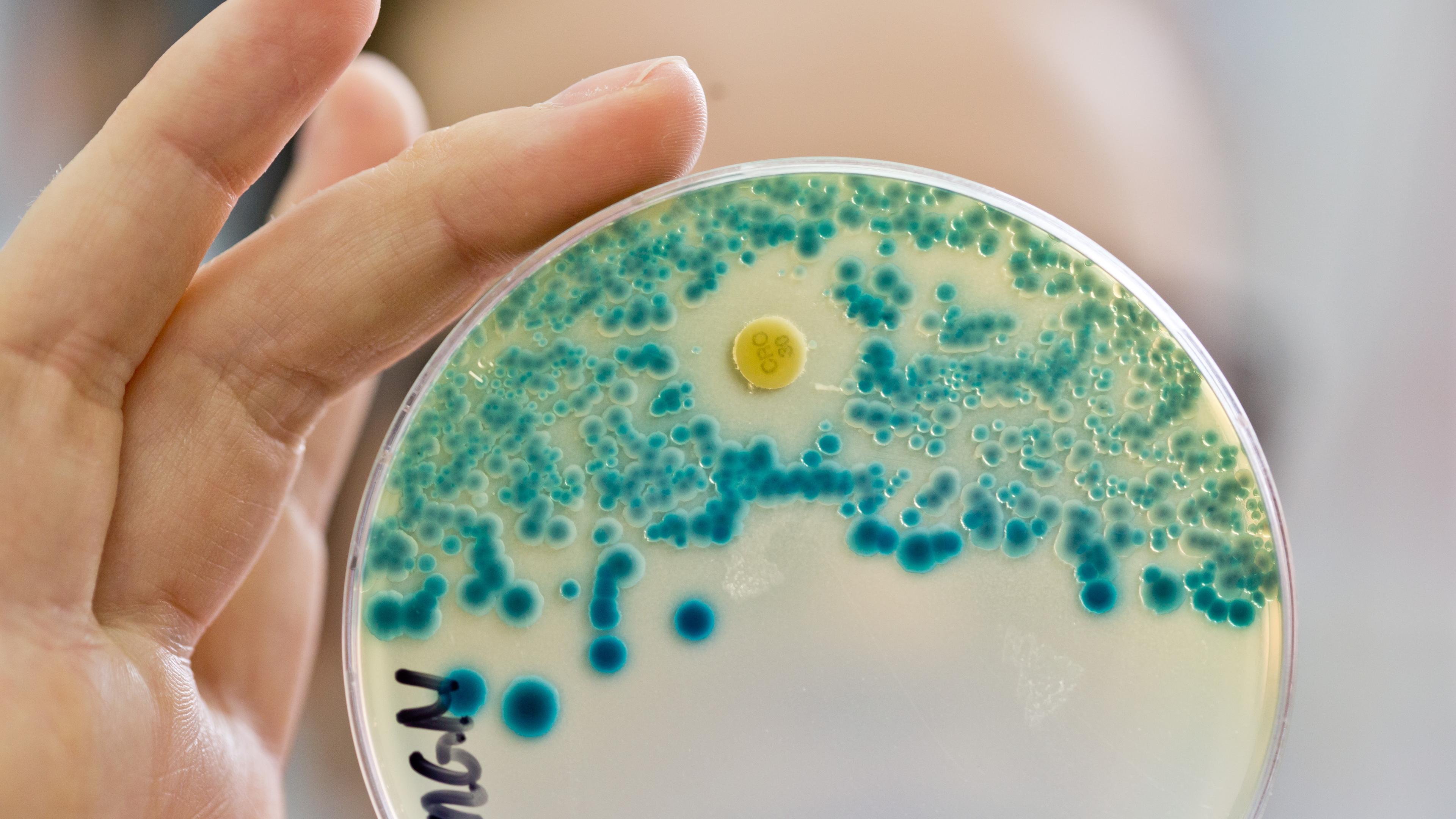 Eine Labormitarbeiterin hält eine Petrischale mit Bakterien in der Hand.