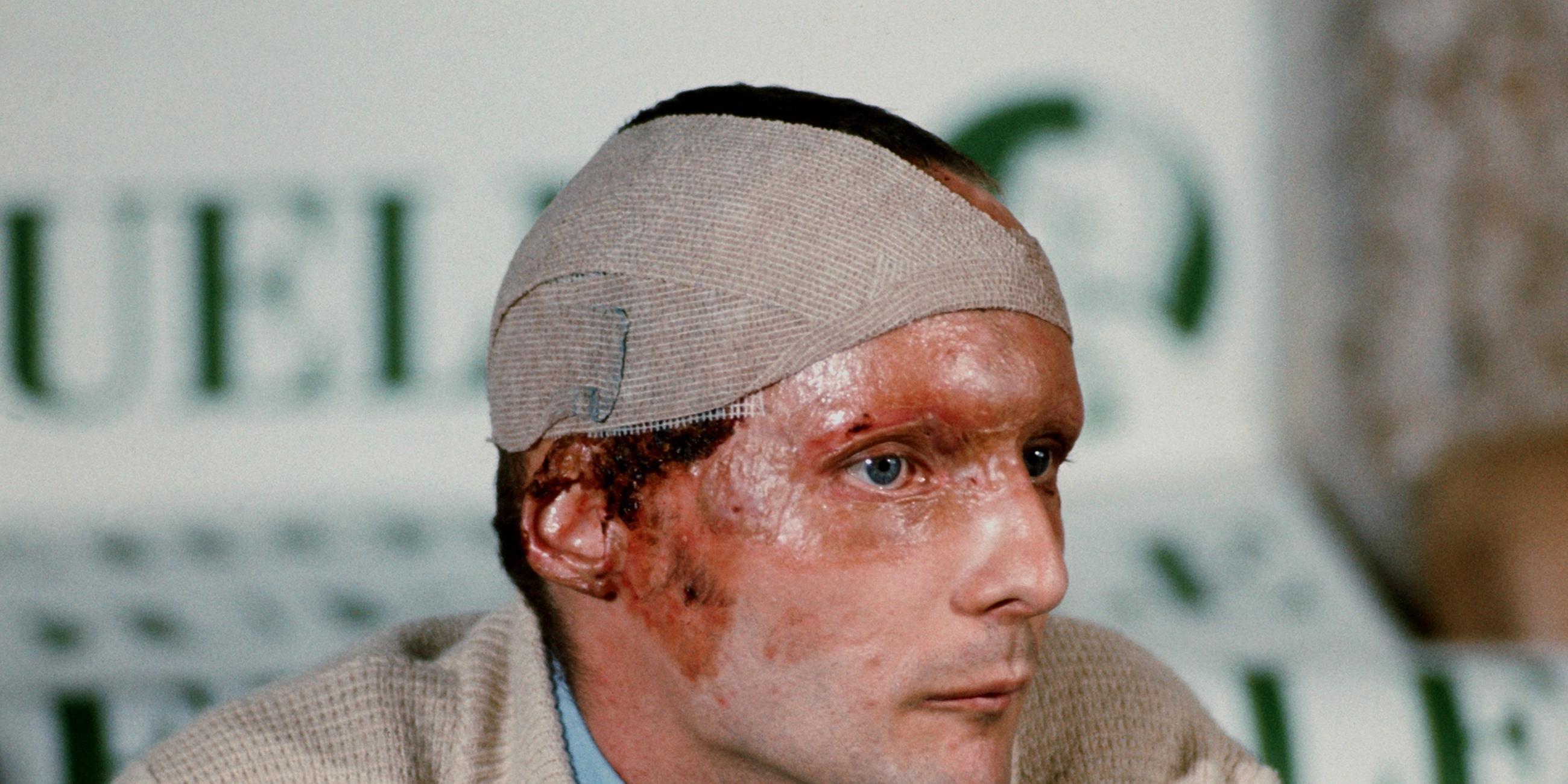 Niki Lauda bei Pressekonferenz nach Unfall