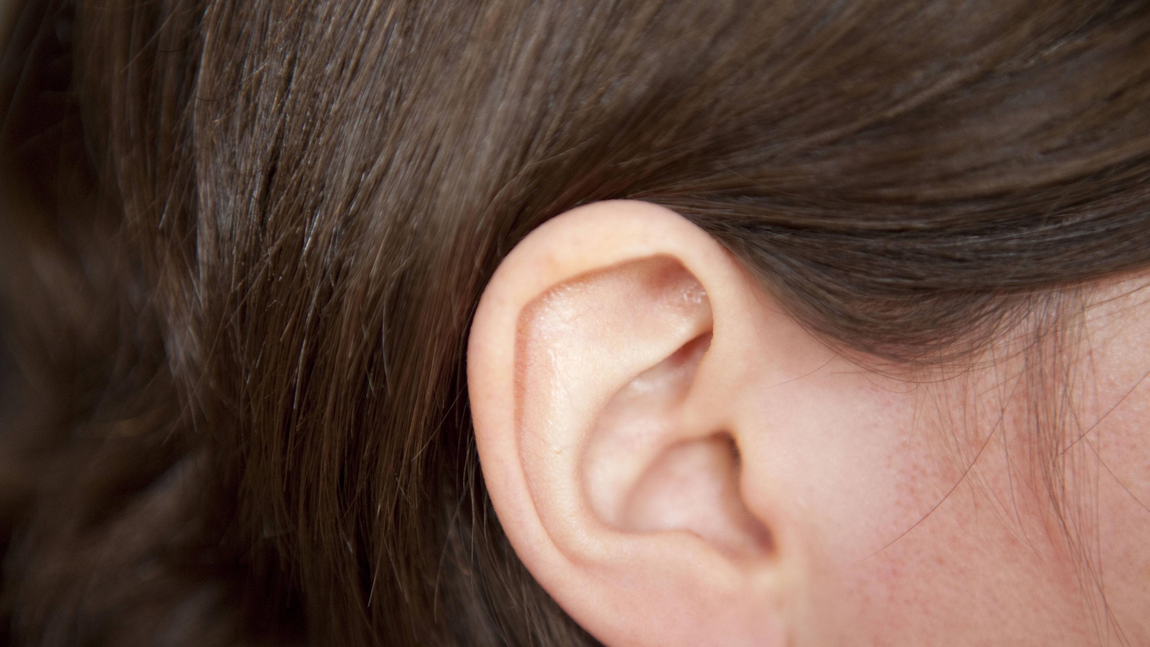 Ohren ohne op anlegen abstehende Abstehende Ohren