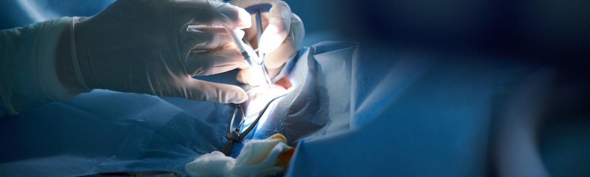 Archiv: Chirurgen während einer Operation (Symbolfoto)