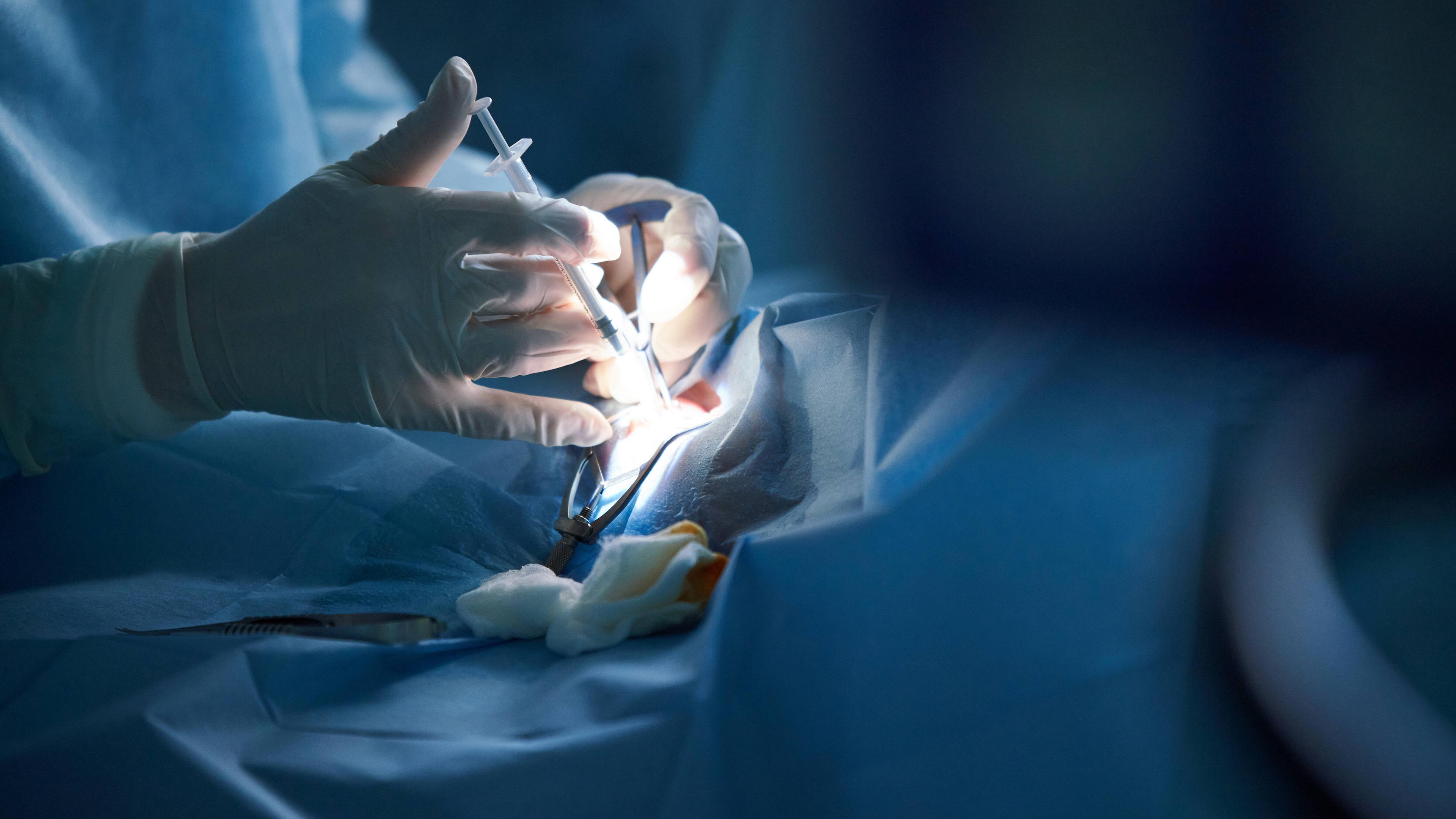 Archiv: Chirurgen während einer Operation (Symbolfoto)