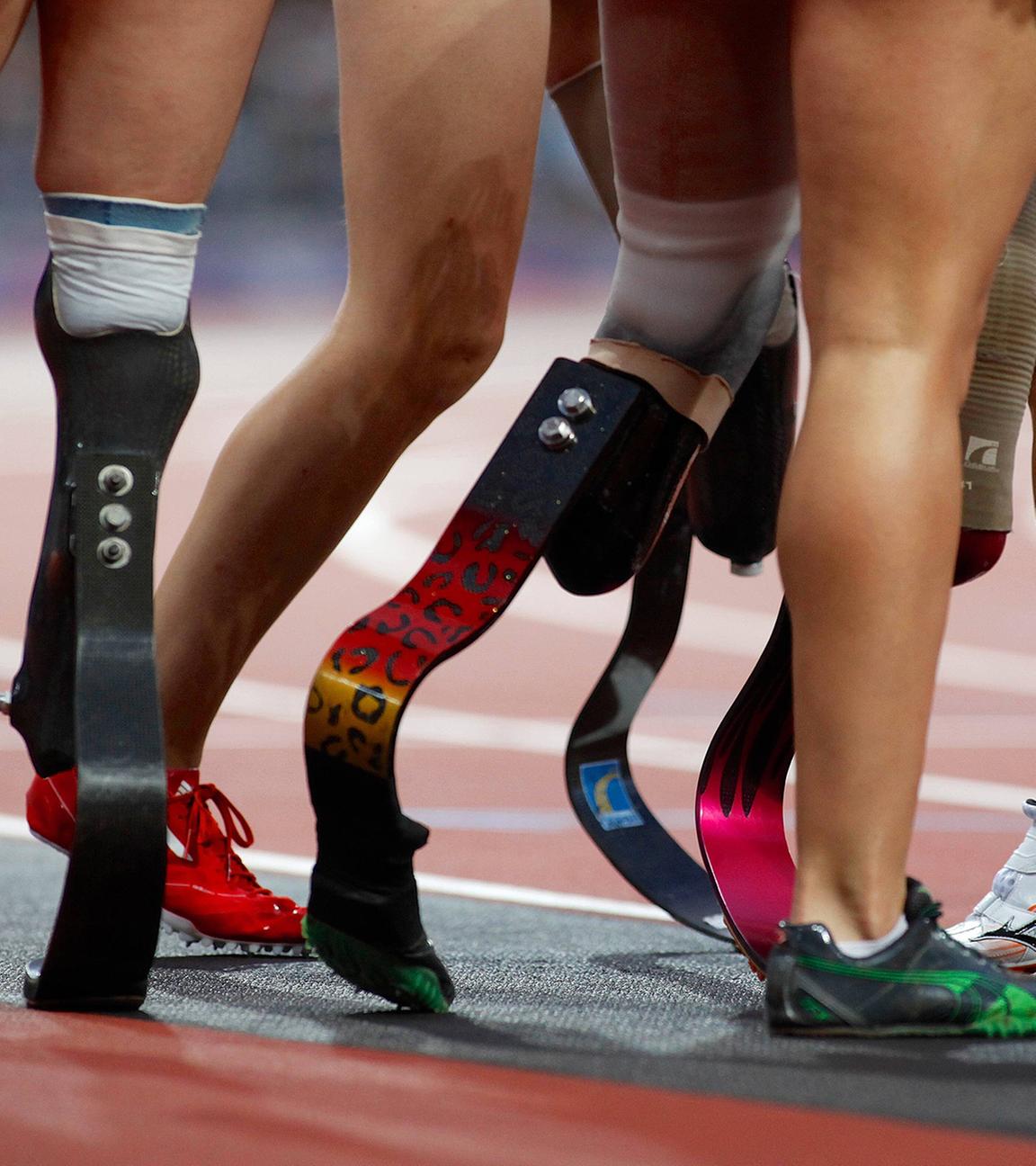 Paralympics: Sprint der Beinamputierten (Symbolbild)