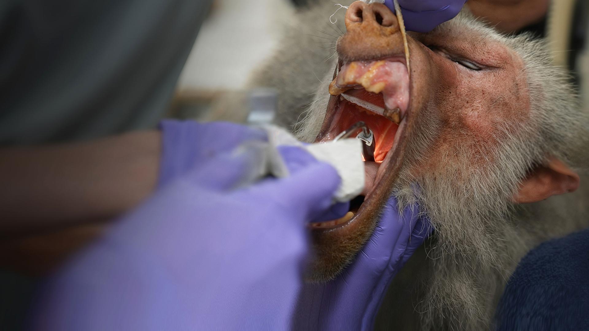 Ein Pavian unter Narkose wird operiert. Er wird mit weit geöffnetem Mund untersucht. Dabei kommen verschiedene Geräte und eine Taschenlampe zum Einsatz.