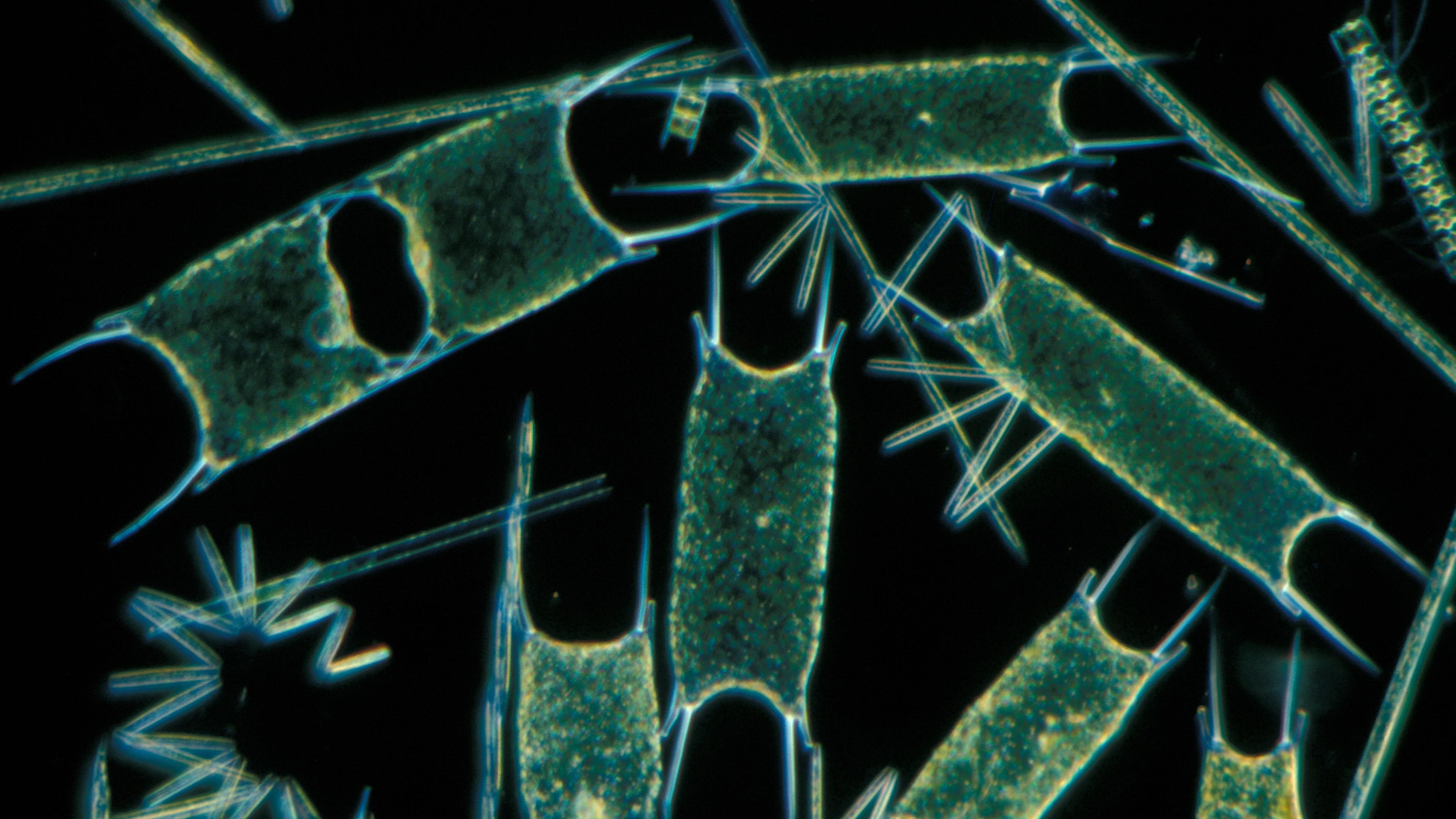 Фитопланктон уровень. Фитопланктон диатомовые водоросли. Диатомовые водоросли Байкала. Диатомовые водоросли под микроскопом. Фитопланктон под микроскопом.