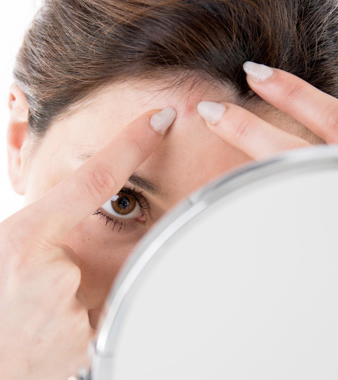 Eine Frau drückt sich vor dem Spiegel einen Pickel an der Stirn aus.